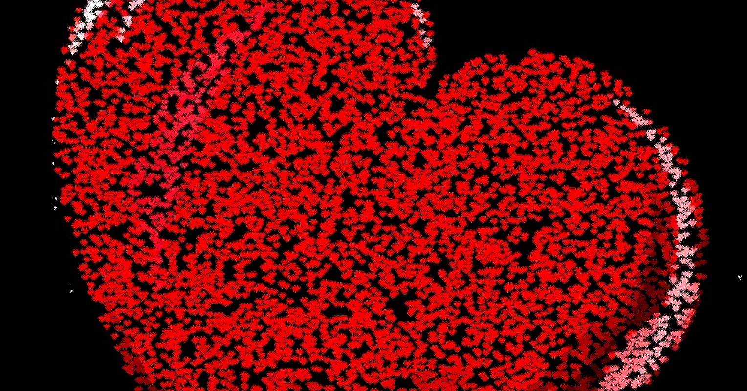 Can a Broken Heart Kill You?